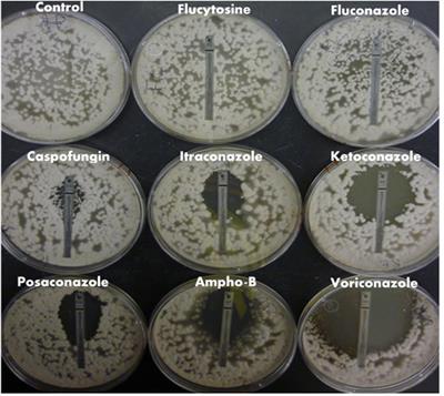 Accumulation of Azole Drugs in the <mark class="highlighted">Fungal Plant Pathogen</mark> Magnaporthe oryzae Is the Result of Facilitated Diffusion Influx